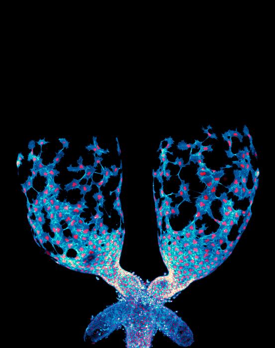 organ-sculpting-cells-could-reveal-new-insights-into-cancer-spread