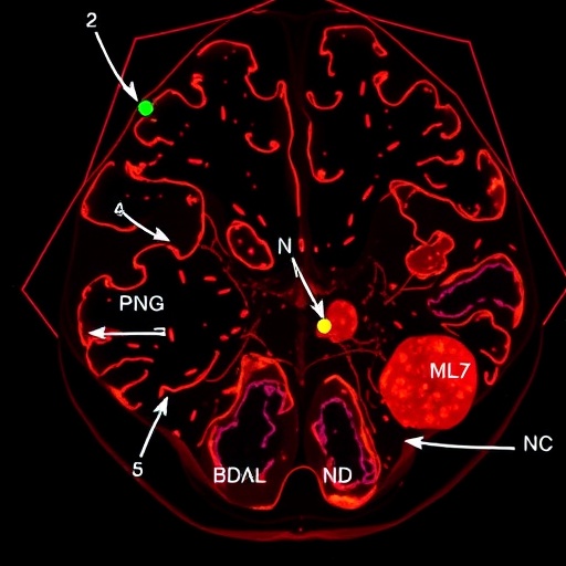 ddx1-methylation-controls-matr3-splicing,-driving-disc-degeneration