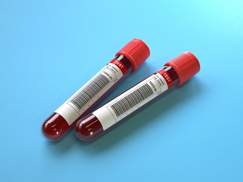 quest-diagnostics-to-carry-fujirebio’s-fda-cleared-alzheimer’s-blood-test