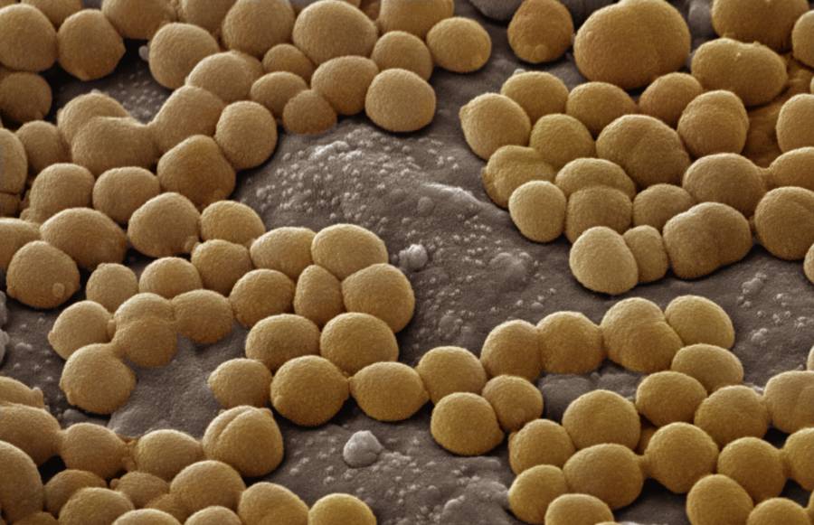 ai-designed-molecules-show-potent-activity-against-resistant-bacteria