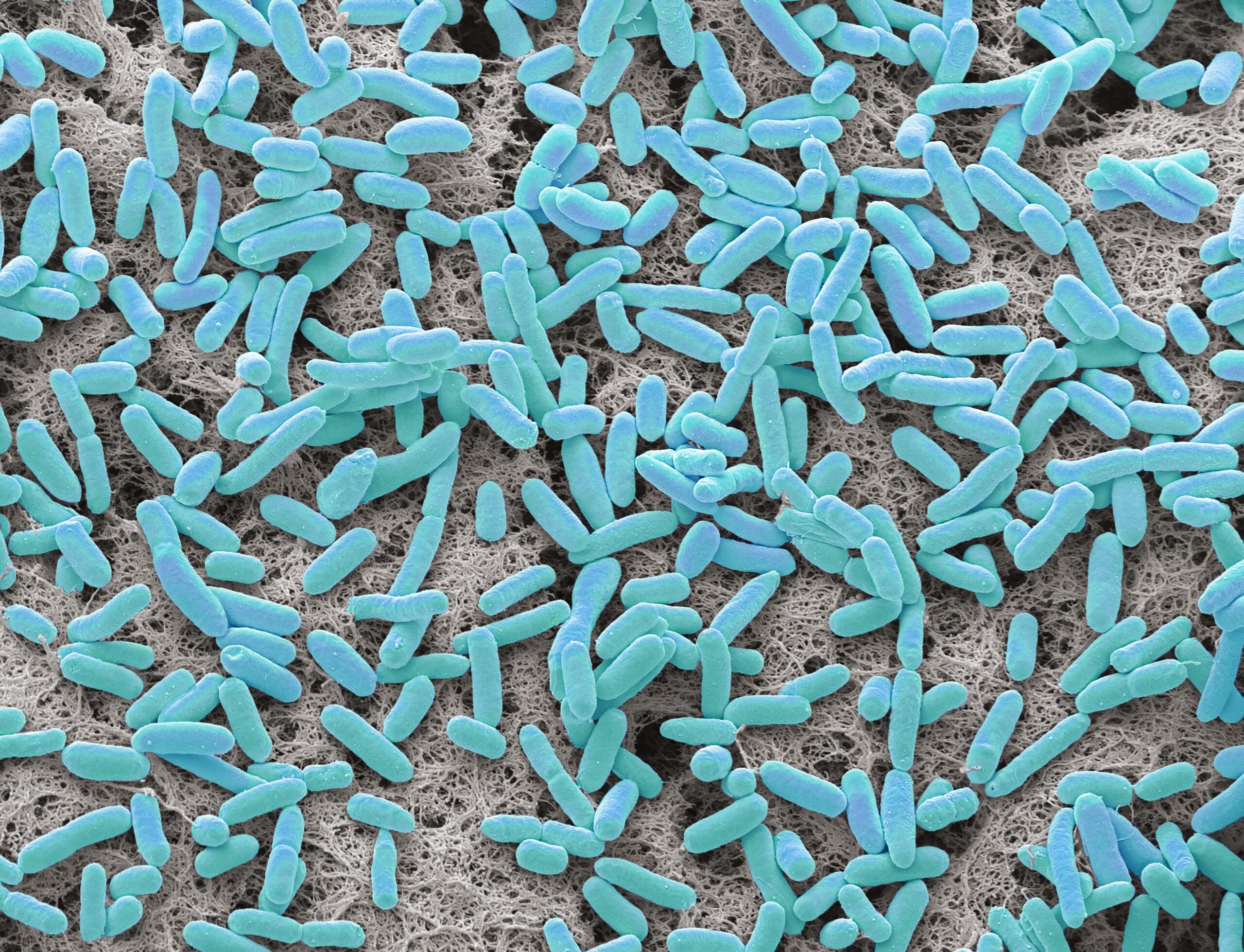 capturing-microbial-memory-with-microcolony-seq-reveals-infection-subpopulations