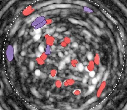 brain-region-identified-as-“dial”-that-can-amplify-or-repress-consumption-in-mice