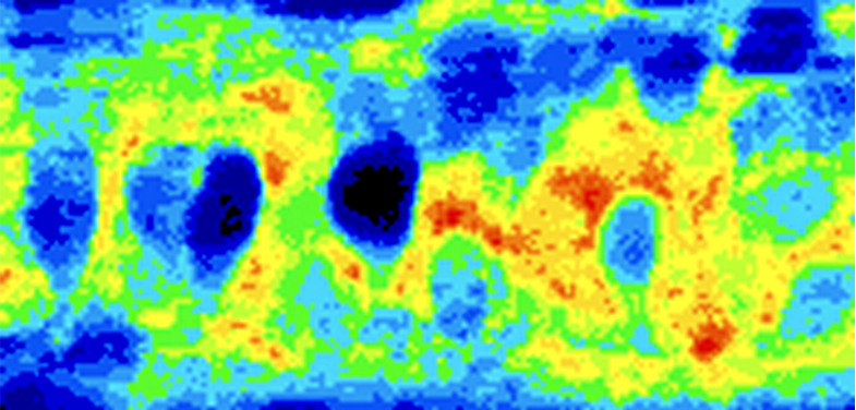 als-linked-to-proteostatic-burden-in-vulnerable-motor-neurons