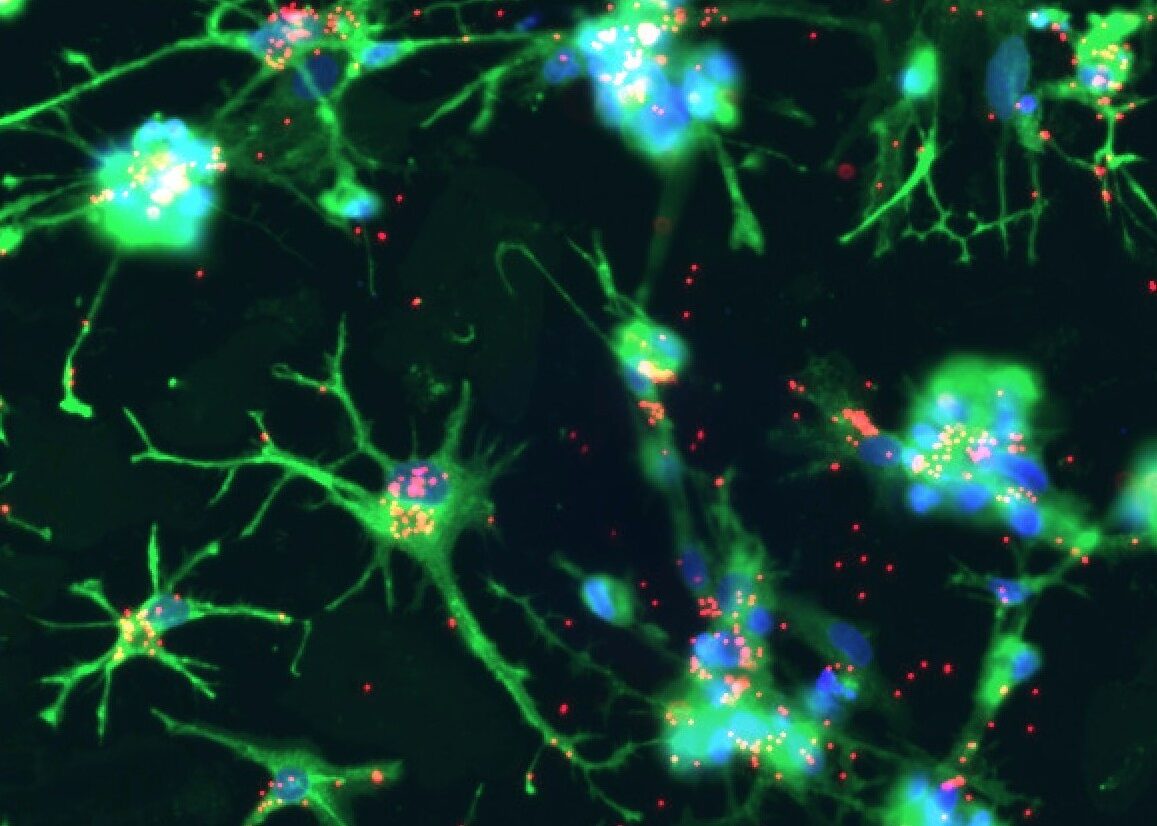 recursion,-roche-unveil-microglia-map-of-neuro-disease-targets