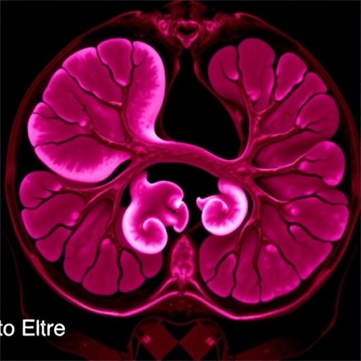 pheochromocytoma-induces-takotsubo-in-young-patients