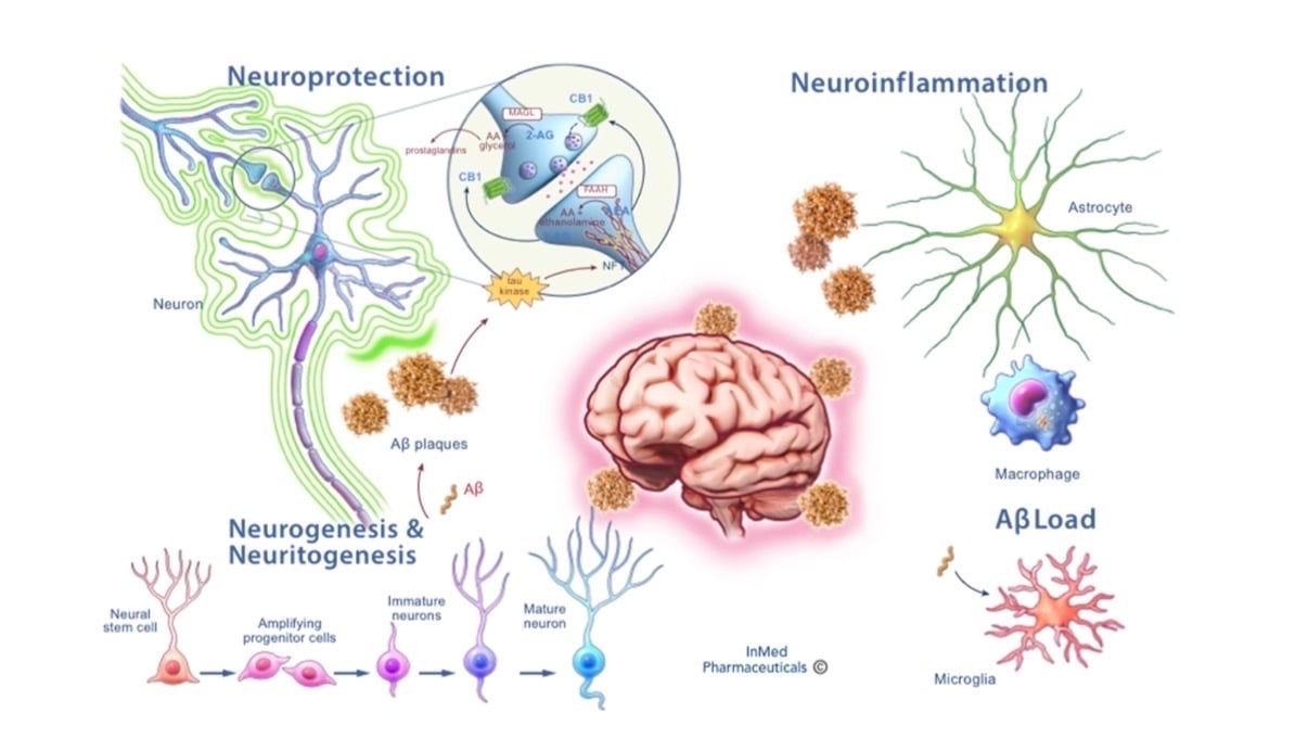 neuroinflammation-a-key-underlying-factor-in-alzheimer’s-disease-risk