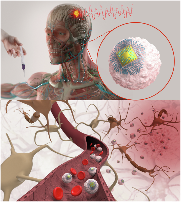 a-nonsurgical-brain-implant-enabled-through-a-cell–electronics-hybrid-for-focal-neuromodulation