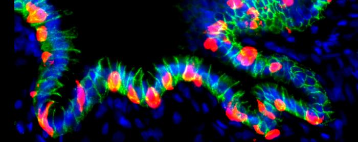 stomach-organoids-reprogrammed-into-insulin-secreting-cells,-offer-path-to-diabetes-therapy