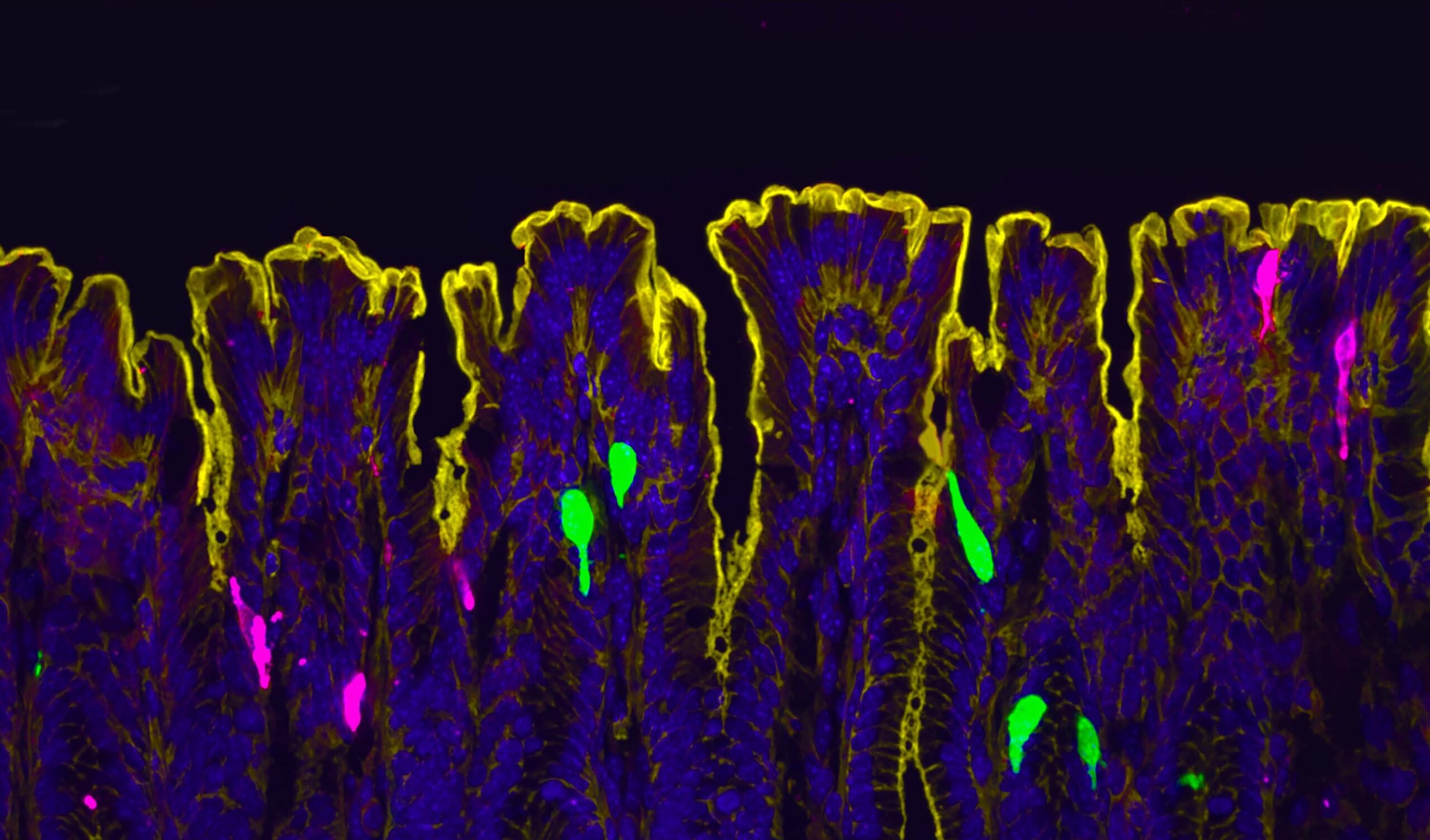 does-estrogen-increase-chronic-gastrointestinal-pain?