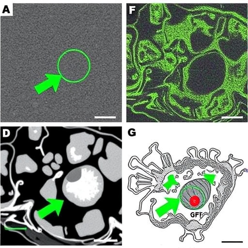 targeting-fgf1-fgfr2-via-rorγ-halts-cholangiocarcinoma
