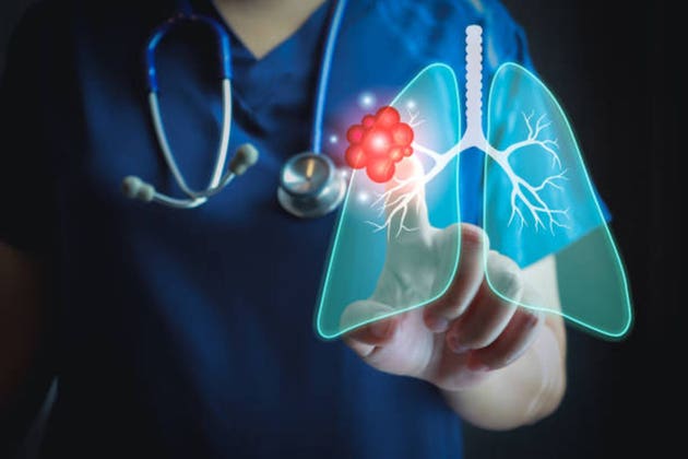 immunitybio-releases-data-on-anktiva-for-non-small-cell-lung-cancer