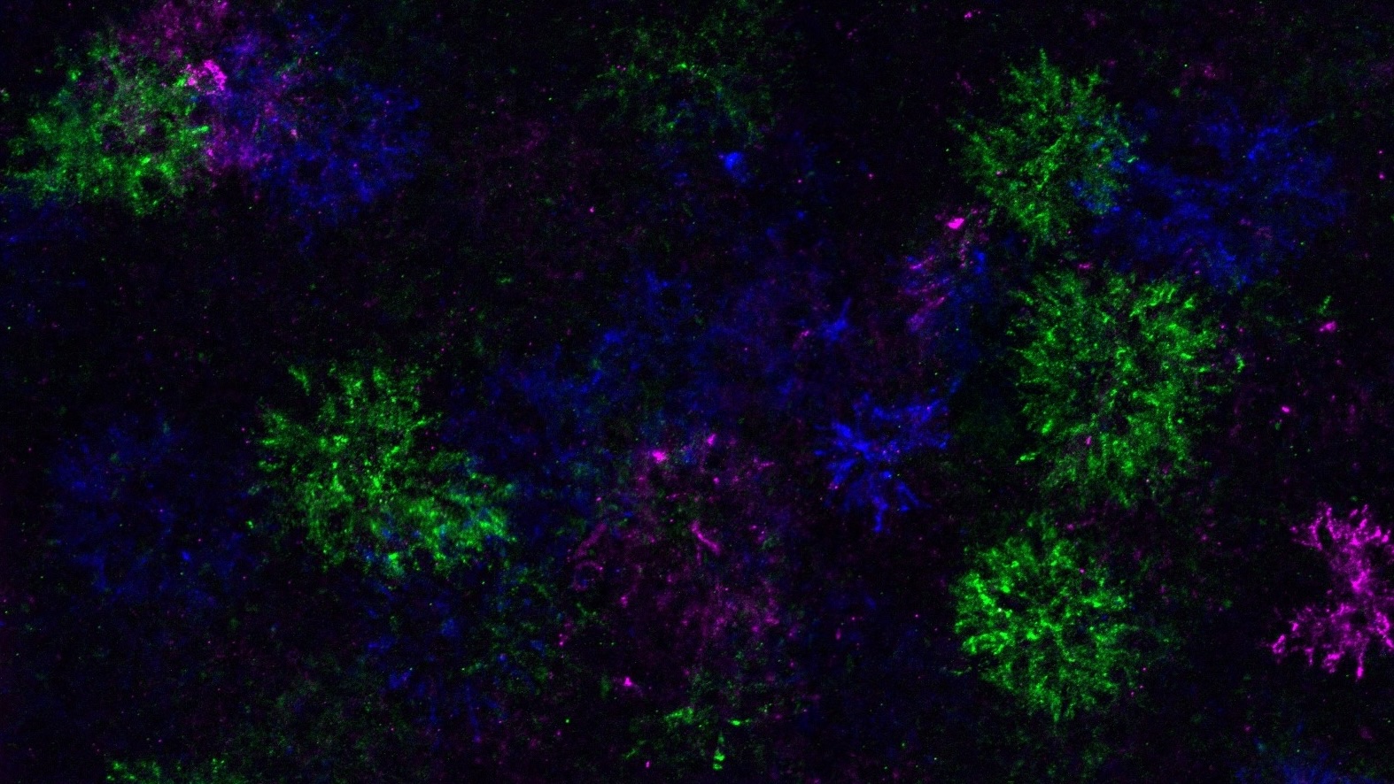 oligodendrocyte-differentiation-holds-promise-for-ms-treatment-development