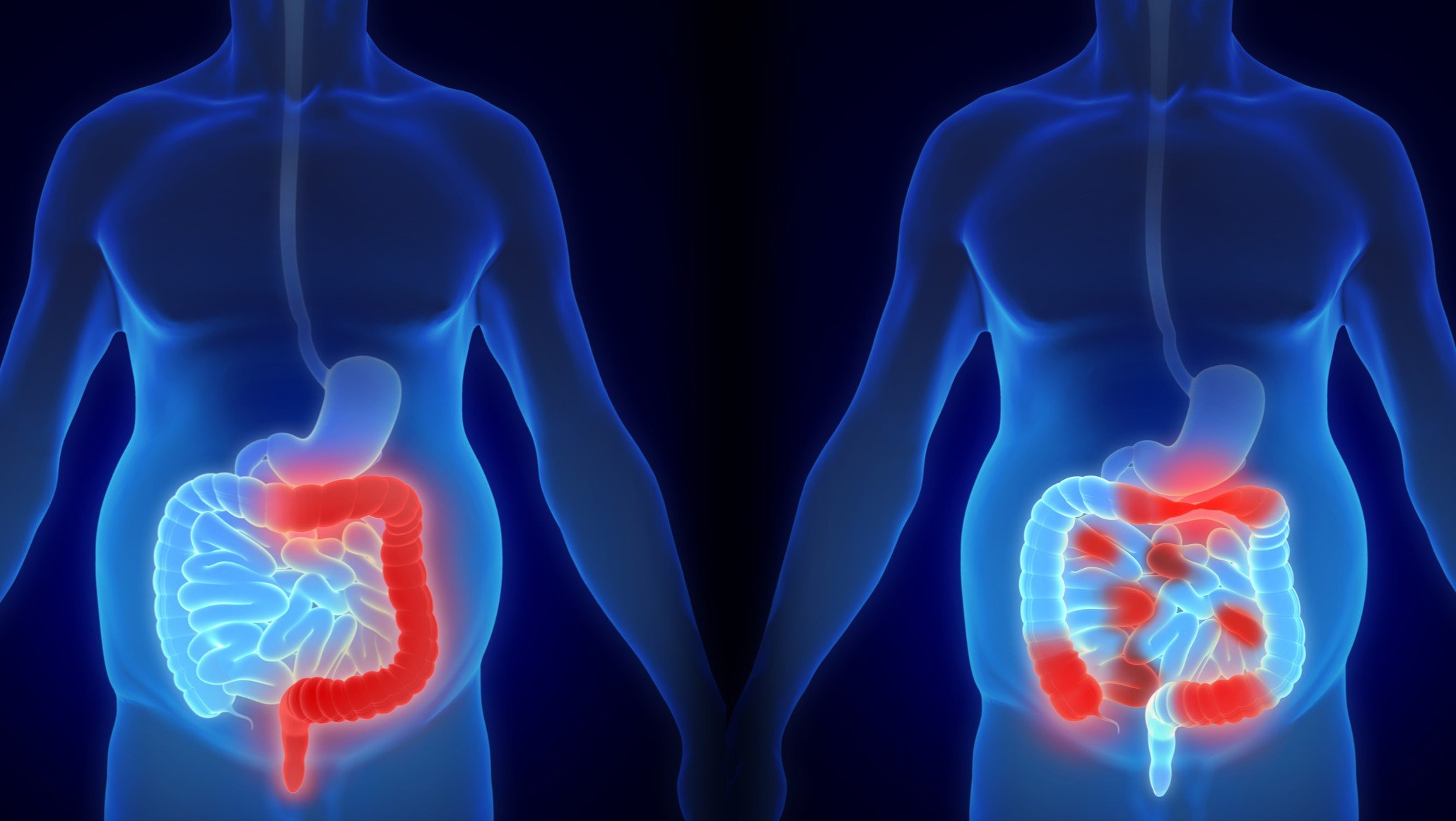 boehringer-pens-e1.05b-deal-for-simcere’s-preclinical-ibd-bispecific