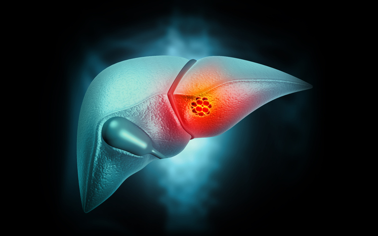 mutation-map-indicates-how-alterations-in-key-cancer-gene-influence-tumor-growth