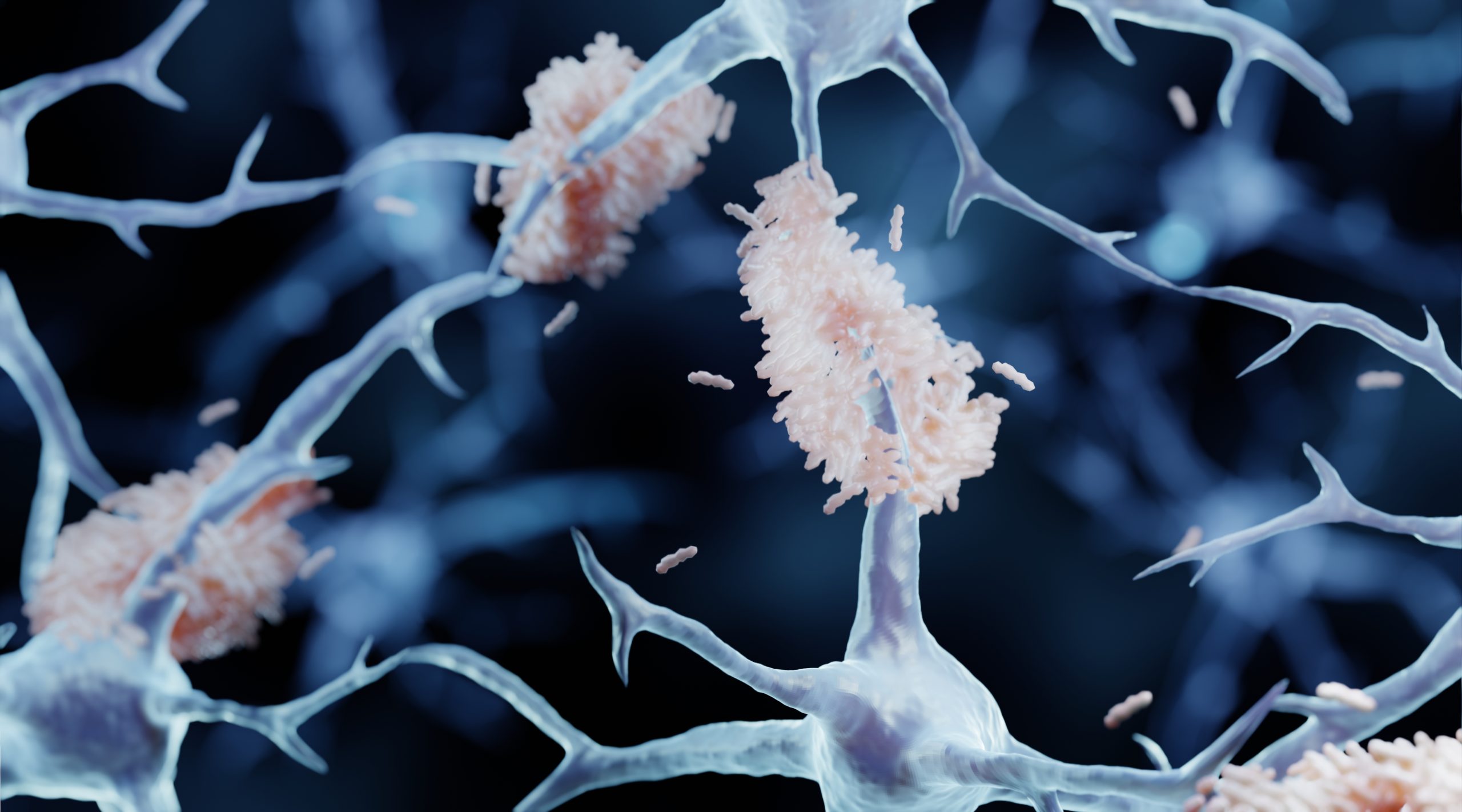 anti-epileptic-drug-may-prevent-early-plaque-formation-in-alzheimer’s-disease