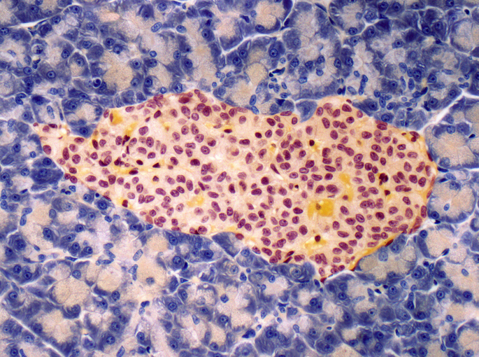 electronic-mesh-spurs-islet-cell-maturation,-could-aid-diabetes-care