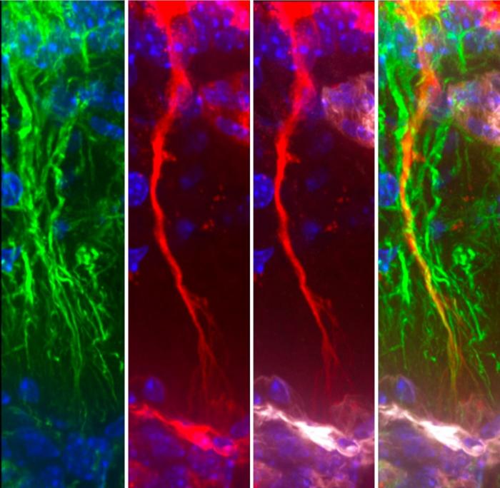 degenerating-tanycytes-disrupt-tau-removal,-shaping-alzheimer’s-progression